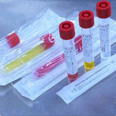The 5 key invisible performance indicators of Viral Transport Medium
