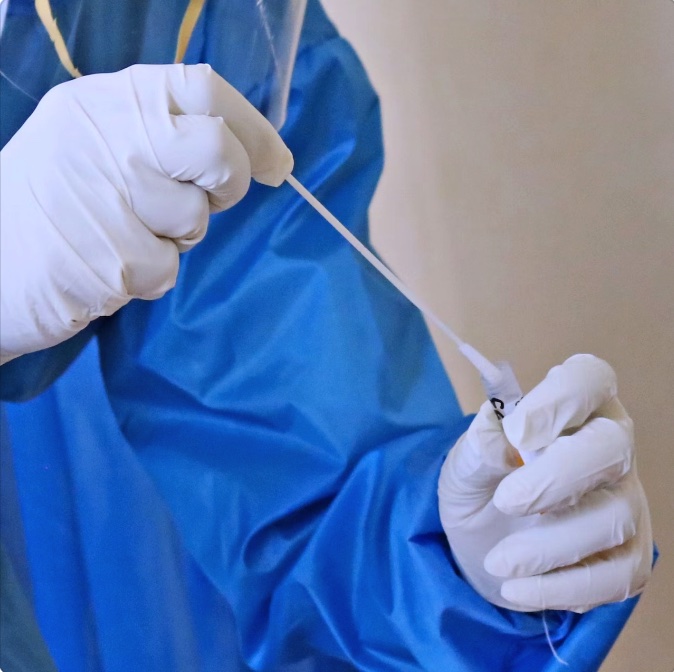 ChatGPT answers 10 key questions about nylon flocked swab